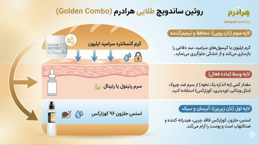 روتین ساندویچ رتینول کوزارکس و ایلیون و اوردینری