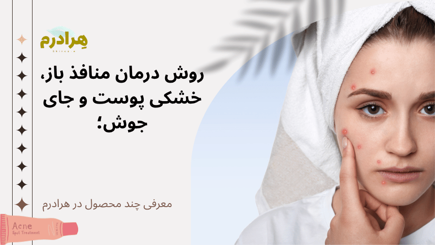 درمان منافذ باز و خشکی و جای جوش